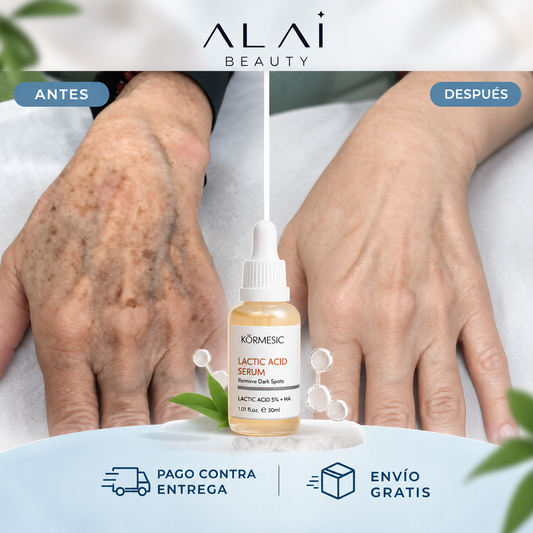 SERUM ELIMINA MANCHAS DE ACIDO LACTICO